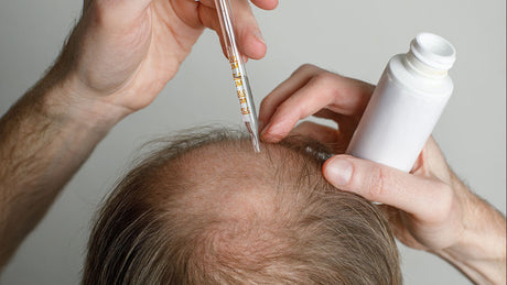 Why You Need a DHT Blocker: Understanding Hair Loss Solutions