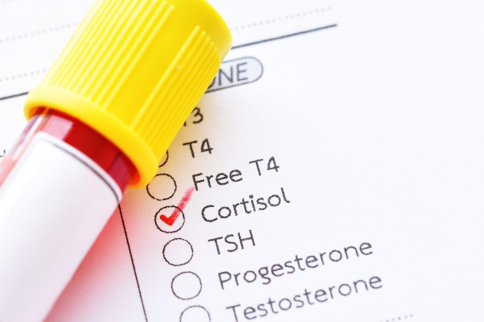 What Should Cortisol Levels Be?