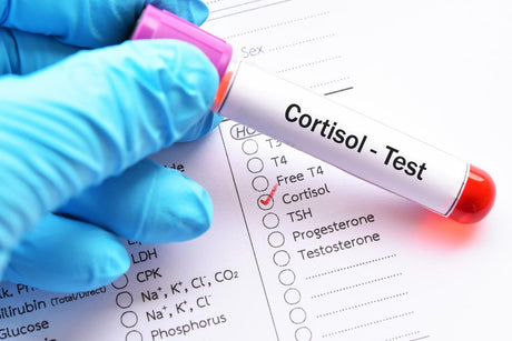 What is Considered a High Cortisol Level?