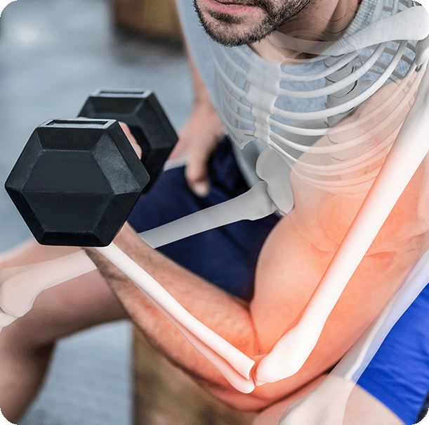 PRIMEGENIX Bone Complex