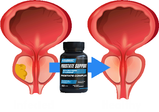 PrimeGENIX Prostate Support